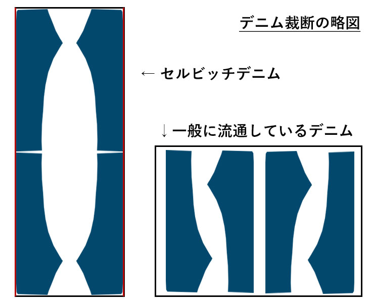 セルビッチパターン略図